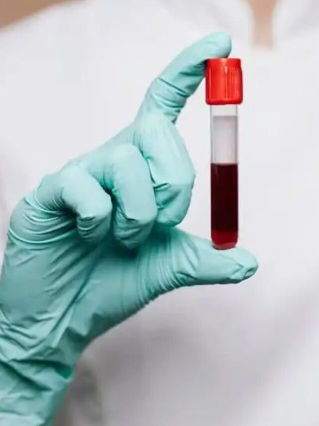 लंबी और हेल्दी जिंदगी चाहते हैं जीना, तो जरूर कराएं ये 3 टेस्ट